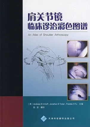 肩关节镜临床诊治彩色图谱