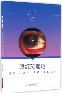 眼红斑痤疮