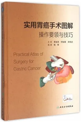 实用胃癌手术图解 操作要领与技巧