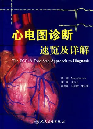 心电图诊断速览及详解