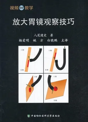放大胃镜观察技巧