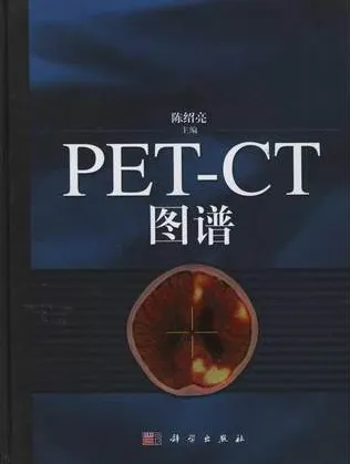 PET-CT图谱