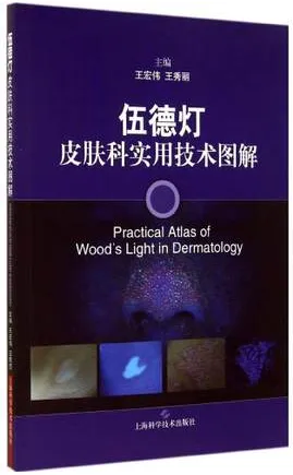 伍德灯皮肤科实用技术图解