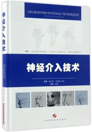 神经介入技术