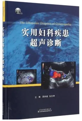 实用妇科疾患超声诊断