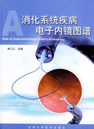 消化系统疾病电子内镜图谱