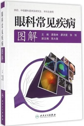 眼科常见疾病图解