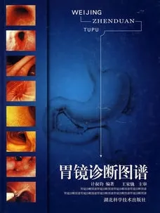胃镜诊断图谱