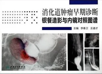 消化道肿瘤早期诊断 钡餐造影与内镜对照图谱