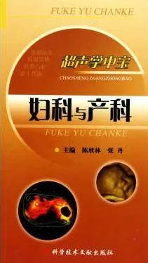 超声掌中宝 妇科与产科