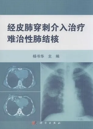 经皮肺穿刺介入治疗难治性肺结核