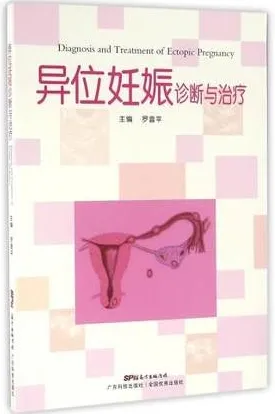 异位妊娠诊断与治疗
