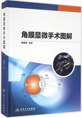 角膜显微手术图解