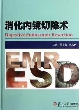 消化内镜切除术