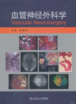 血管神经外科学