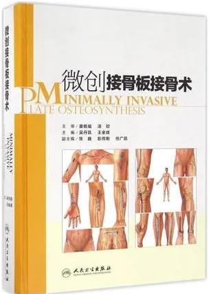微创接骨板接骨术