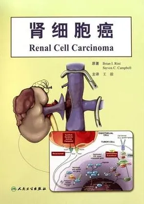 肾细胞癌