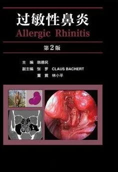过敏性鼻炎 第2版