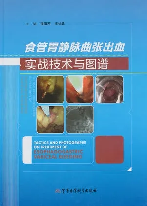 食管胃静脉曲张出血实战技术与图谱