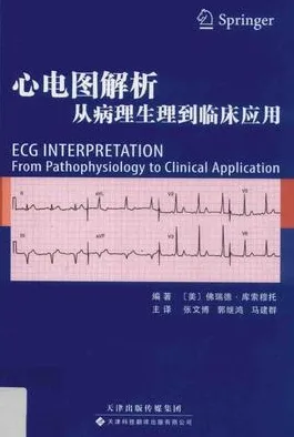 心电图解析 从病理生理到临床应用