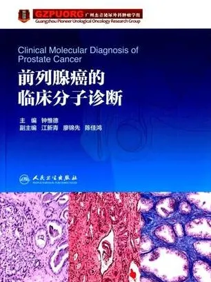 前列腺癌的临床分子诊断