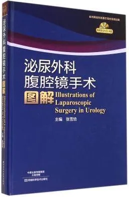 泌尿外科腹腔镜手术图解