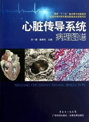 心脏传导系统病理图谱