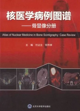核医学病例图谱 骨显像分册