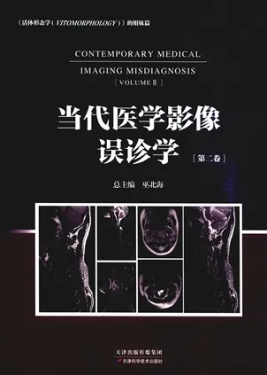 当代医学影像误诊学（第二卷）