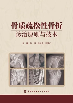 骨质疏松性骨折 诊治原则与技术