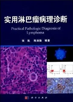 实用淋巴瘤病理诊断